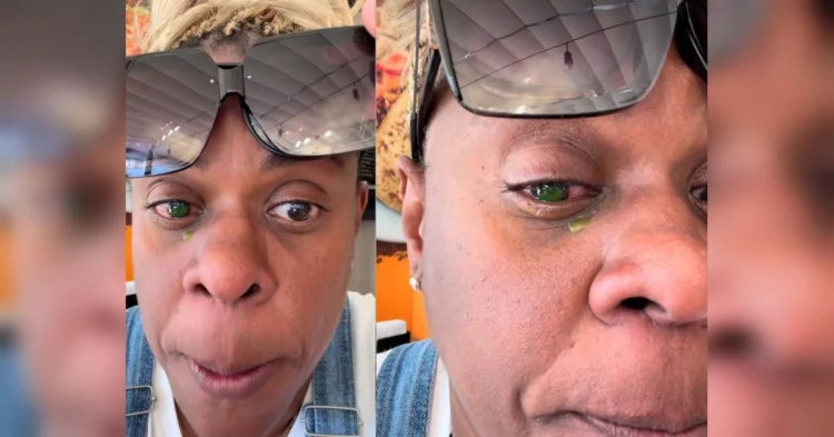 Atriz da Globo perde visão após reação a pomada capilar